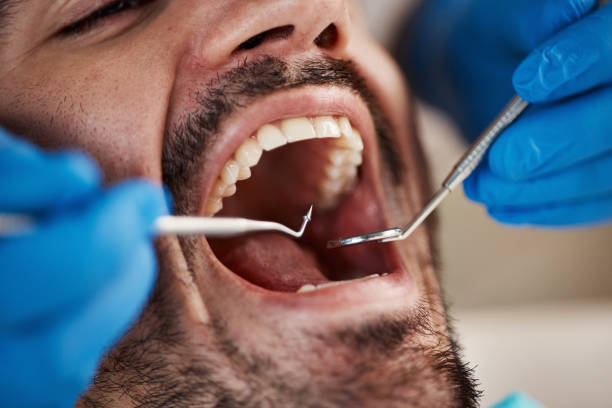 Best Emergency Treatment for Jaw Pain or Injury in Craig Beach, OH